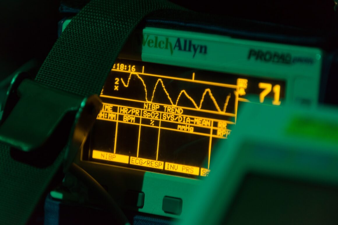 Setting our heart-attack-predicting AI loose with “no-code” tools