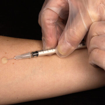 new-transparent-ai-tool-may-help-detect-blood-poisoning New, transparent AI tool may help detect blood poisoning