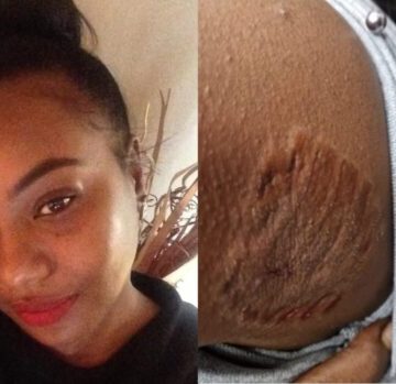 ‘I Could Feel Burning’: Black Woman Claims White Woman Bit Her, Yank Out ‘Clumps’ of Her Hair on Subway and Police Officer Stood By, Let It Happen ‘I Could Feel Burning’: Black Woman Claims White Woman Bit Her, Yank Out ‘Clumps’ of Her Hair on Subway and Police Officer Stood By, Let It Happen