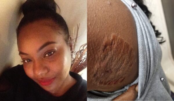 ‘I Could Feel Burning’: Black Woman Claims White Woman Bit Her, Yank Out ‘Clumps’ of Her Hair on Subway and Police Officer Stood By, Let It Happen ‘I Could Feel Burning’: Black Woman Claims White Woman Bit Her, Yank Out ‘Clumps’ of Her Hair on Subway and Police Officer Stood By, Let It Happen