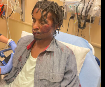 ‘Injustice’: Cops Beat Homeless Veteran, Joke About It After ‘Injustice’: Cops Beat Homeless Veteran, Joke About It After. DOJ Opens Criminal Investigation a Year Later, Man’s Attorney Says