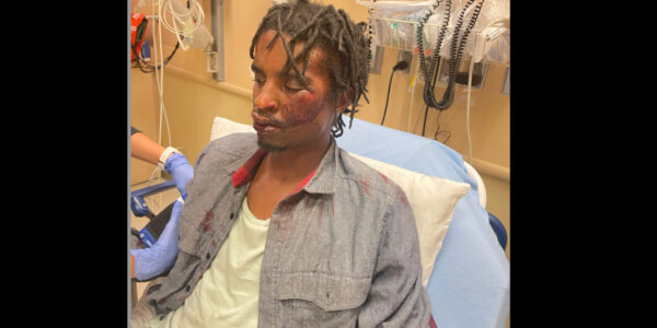 ‘Injustice’: Cops Beat Homeless Veteran, Joke About It After ‘Injustice’: Cops Beat Homeless Veteran, Joke About It After. DOJ Opens Criminal Investigation a Year Later, Man’s Attorney Says